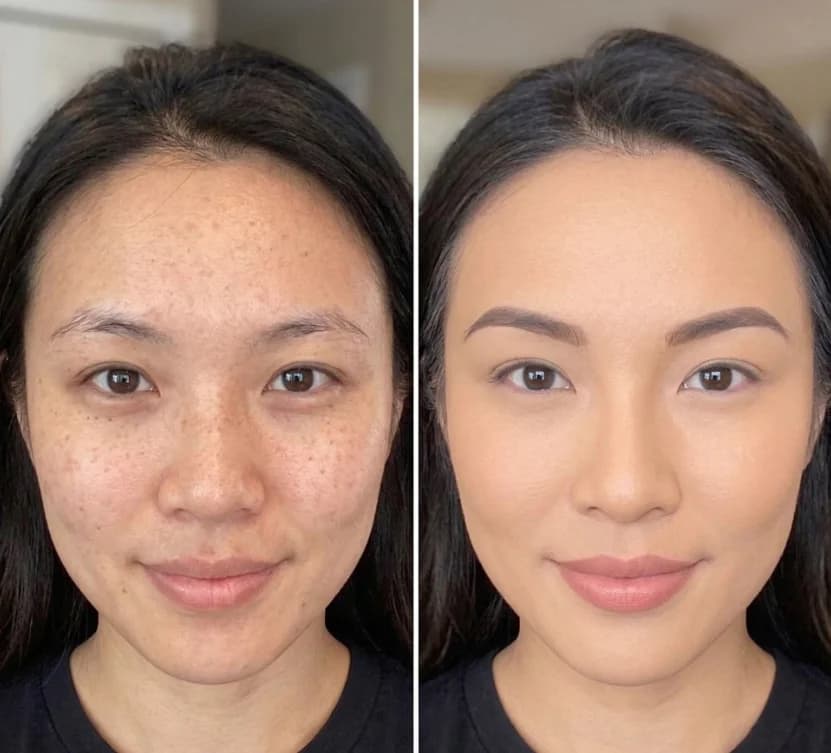 Patient after nano-infusion and glutathione drip at Nexus Clinic — radiant, luminous complexion achieved