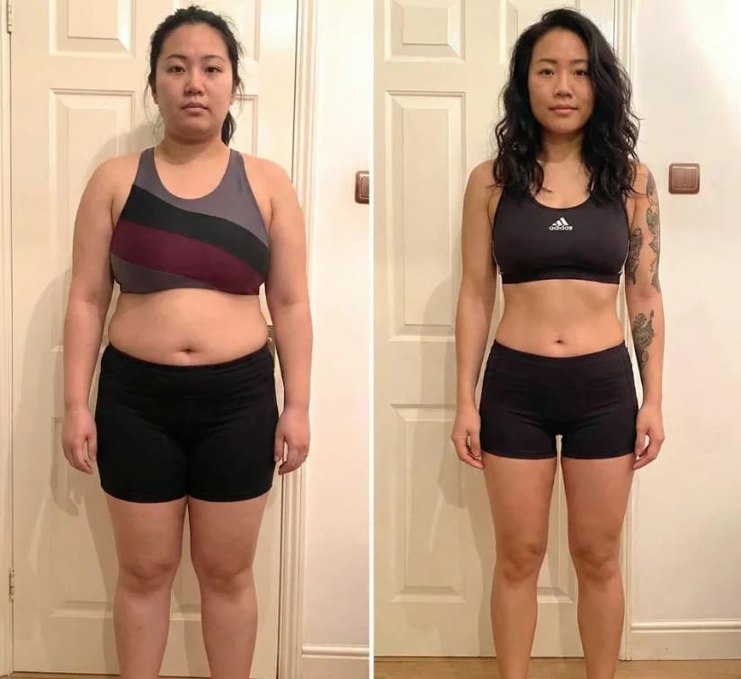 Patient after duromine injection and PRP therapy at Nexus Clinic — reduced abdominal fat and improved skin tone