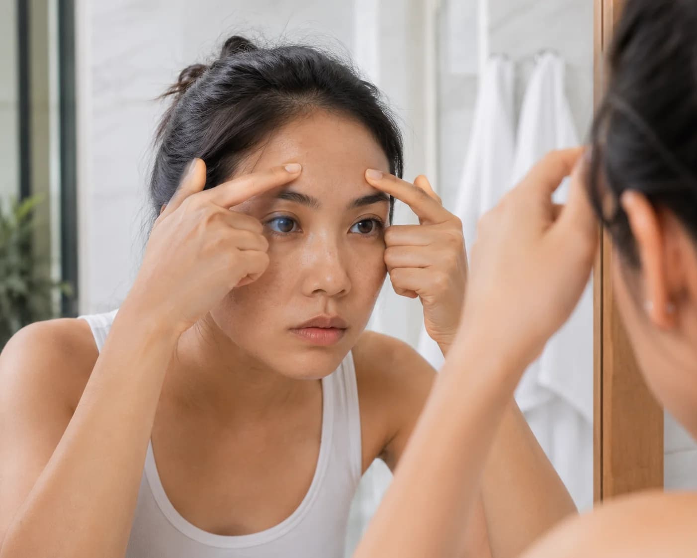 Pore-wall collagen stimulation with Fractional LIOB at Nexus Clinic KL