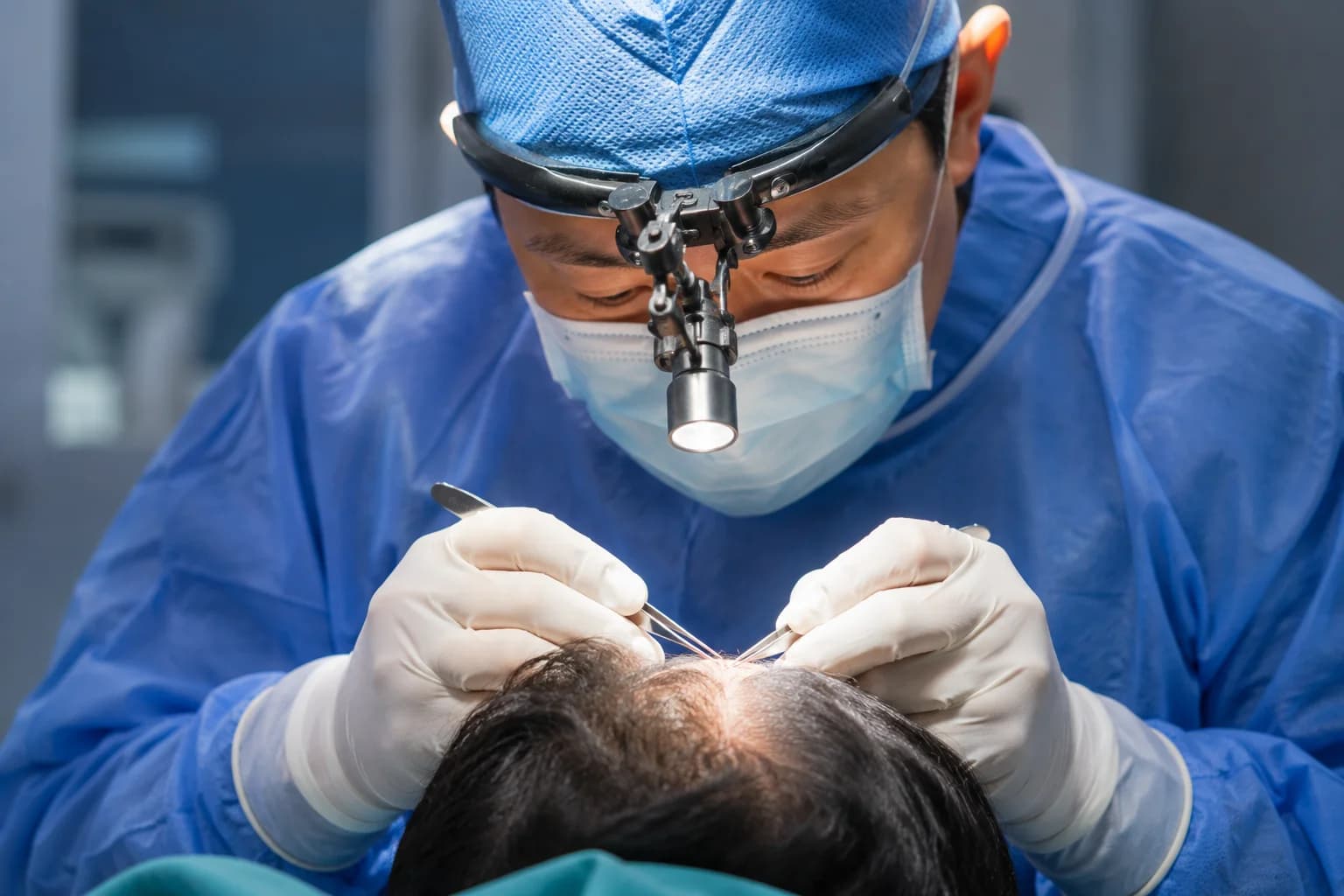 Hair Transplant in Malaysia Cost Procedure and What Determines a Successful Result