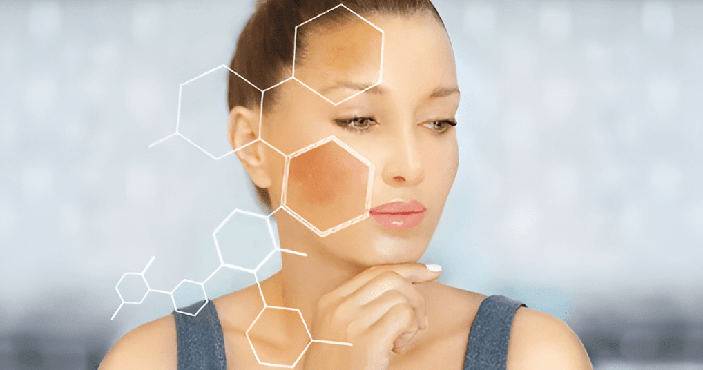 Dermamelan: The Best Treatment for Pigmentation and Dark Spots in Malaysia