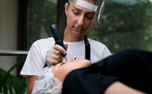 How Smart Laser Technology Is Revolutionizing Tattoo and Scar Removal