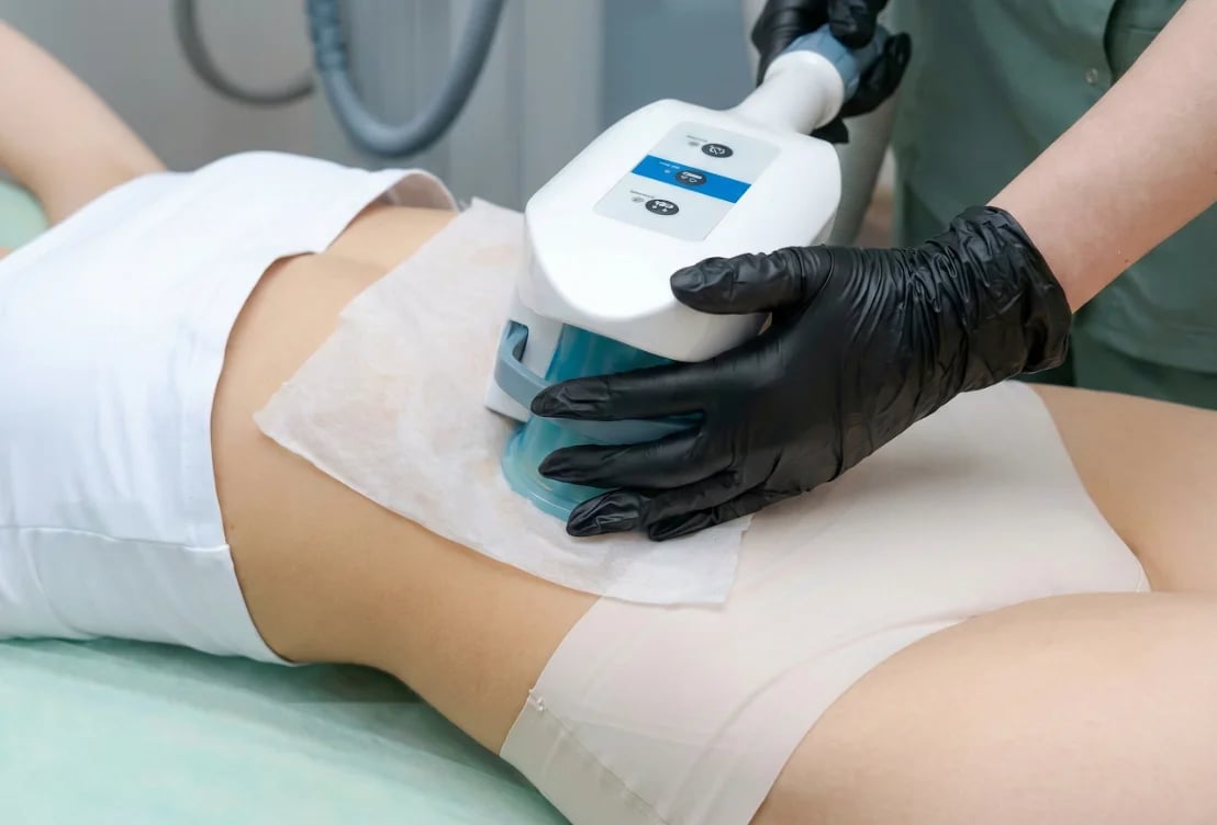 Fat Freezing Treatment at Nexus Clinic Kuala Lumpur
