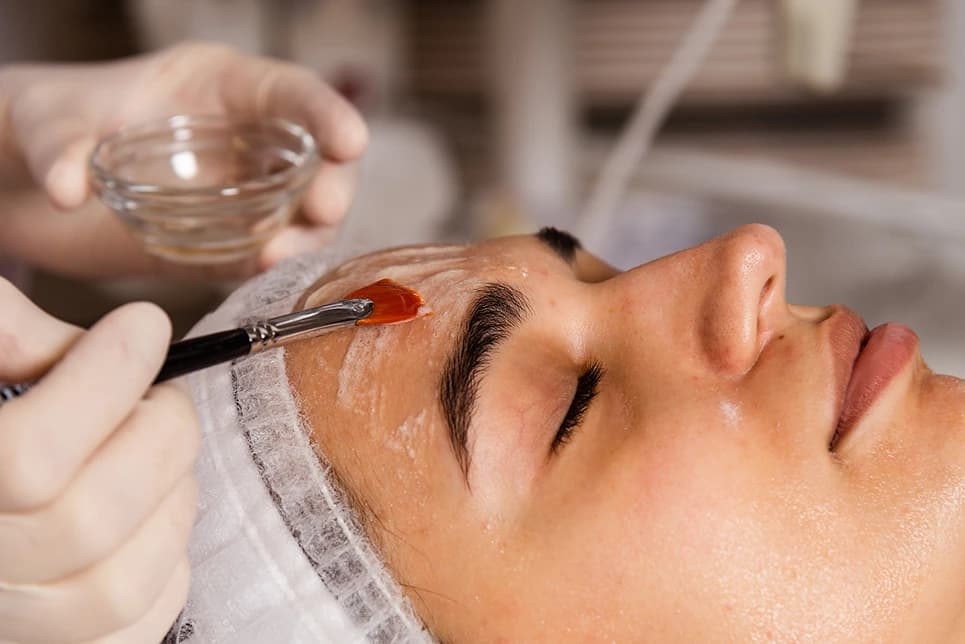 Pigmentation Laser or Chemical Peel? Best Fixes for Asian Skin Tones