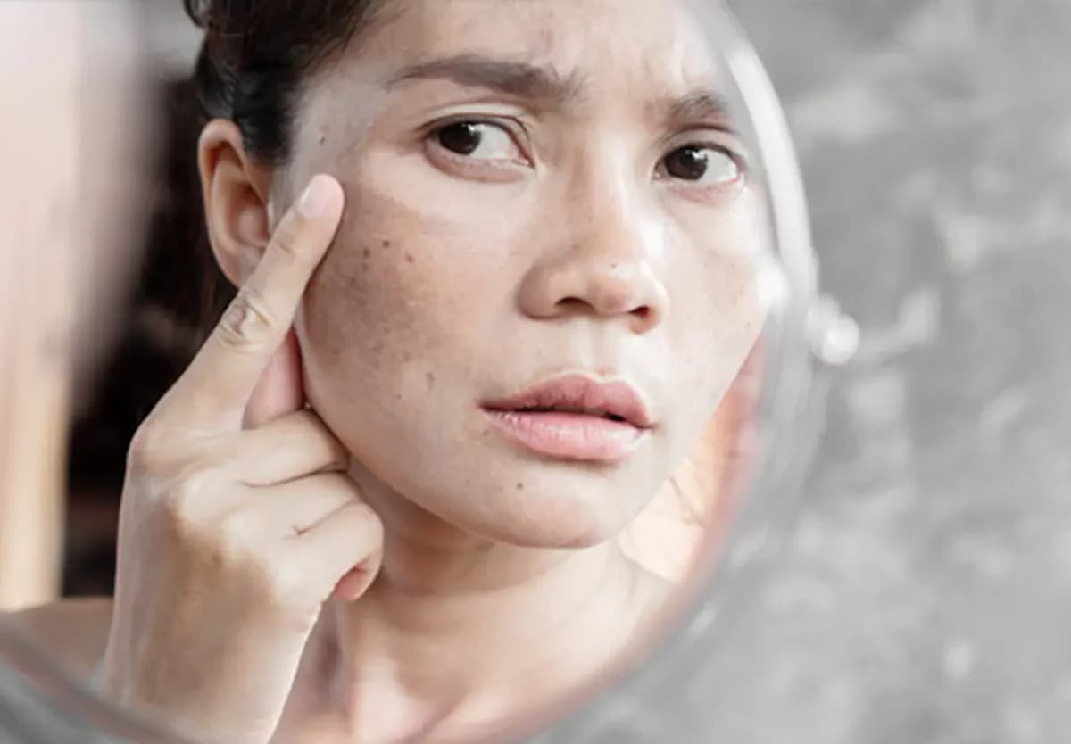 Top Dark Spot Correctors Dermatologists Love in 2026 – Malaysia’s Expert Guide