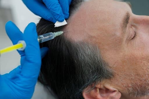 Hair Restoration 2026: Stem Cell and PRP Therapy Leading the Way