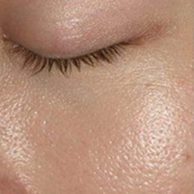 Reduces The Absorption Of The Chemical
