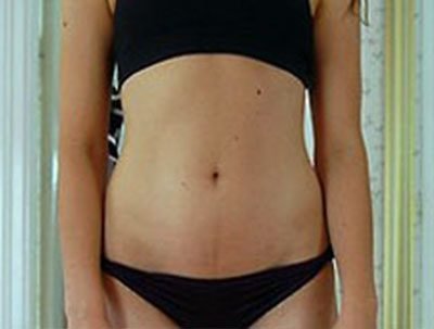 Flat stomach before.