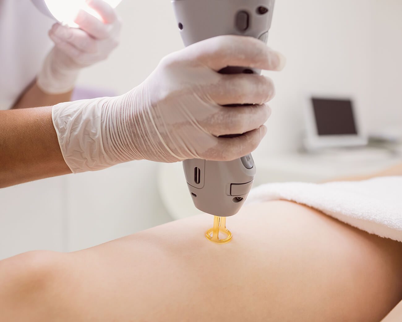 doctor performing laser hair removal female patient skin clinic