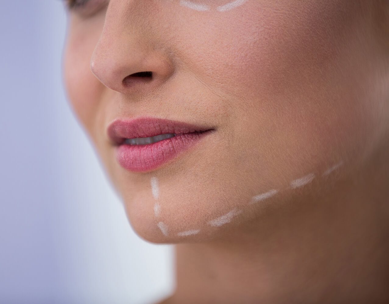 woman with marks drawn cosmetic treatment her jaw