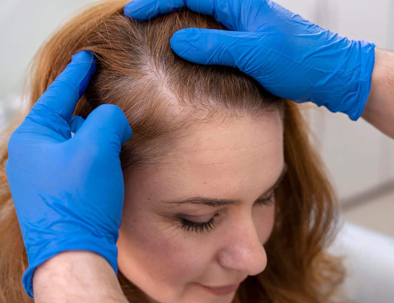 woman getting hair loss treatment clinic