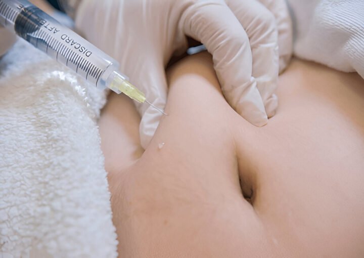 MesoLipo Fat Melting Injection Review