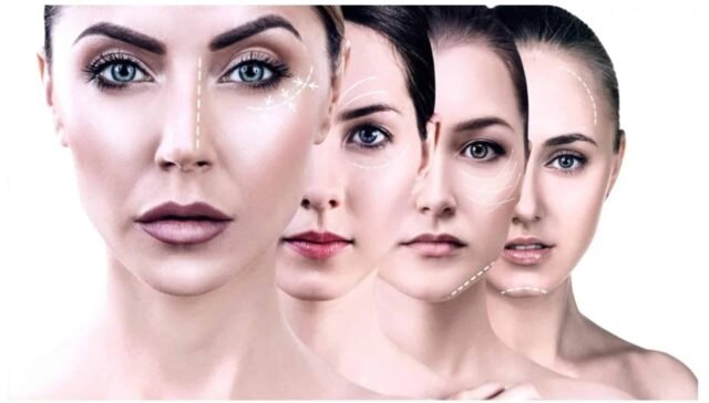 DERMA FILLERS