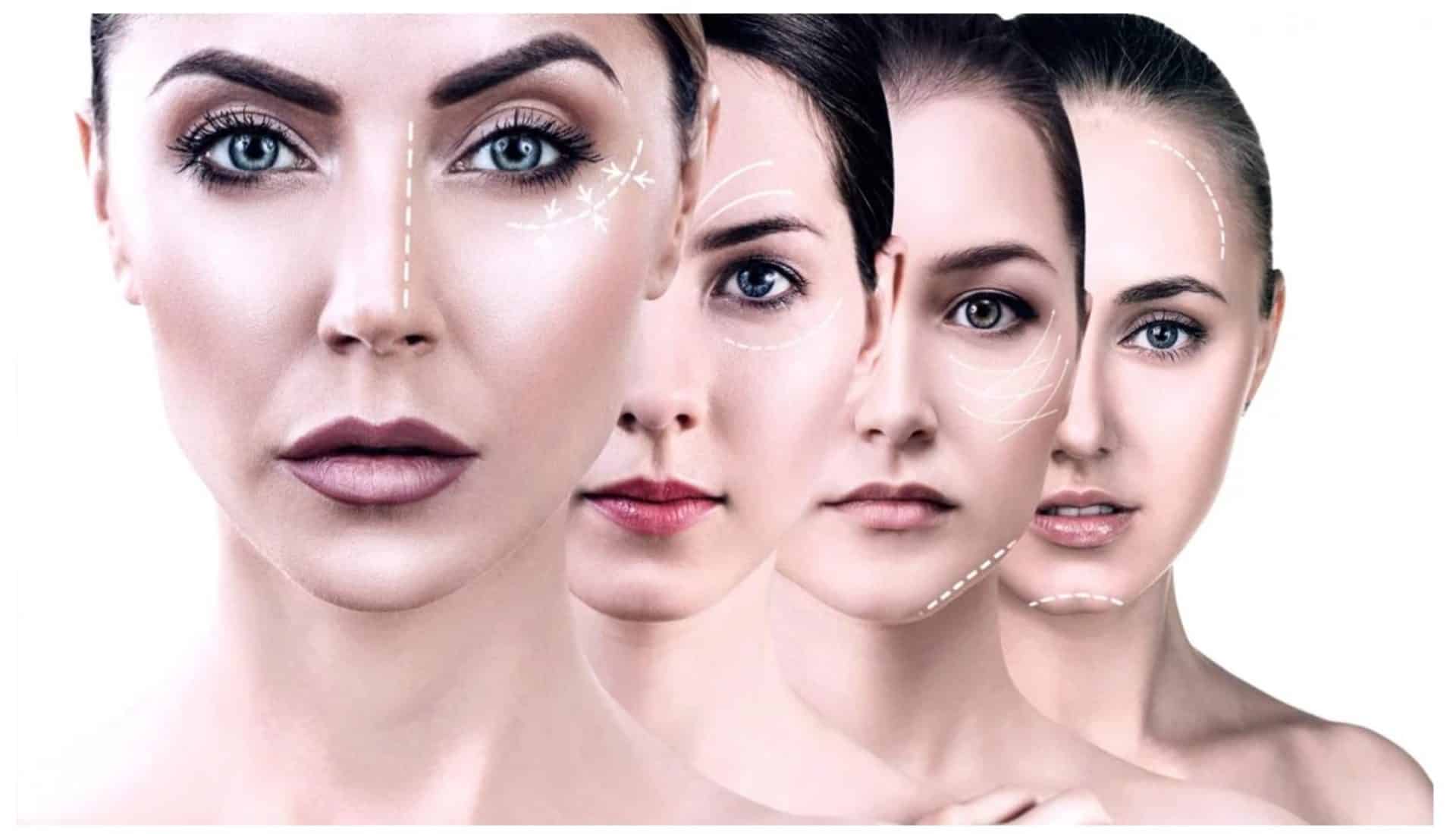 dermal fillers 1