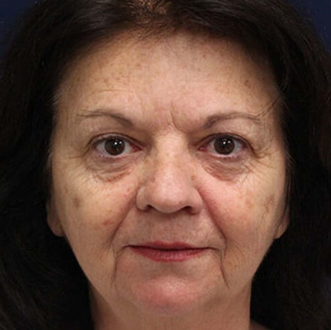 Reduces Menopause Symptoms