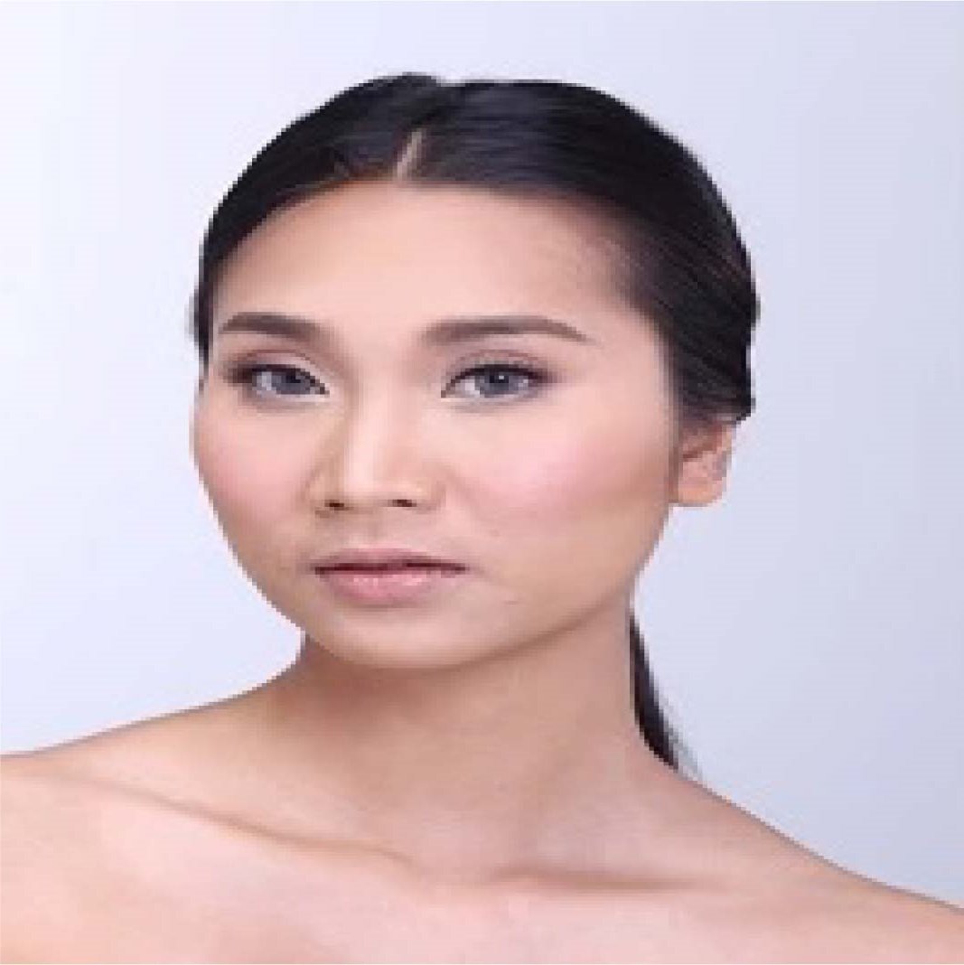 Mesobrightening Skin Treatment Before and After 107 1