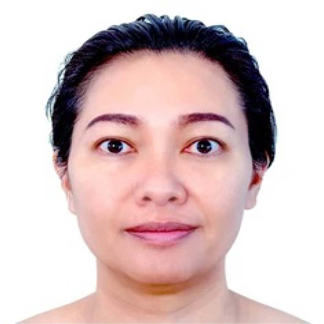 Mesobrightening Skin Treatment Before and After 109