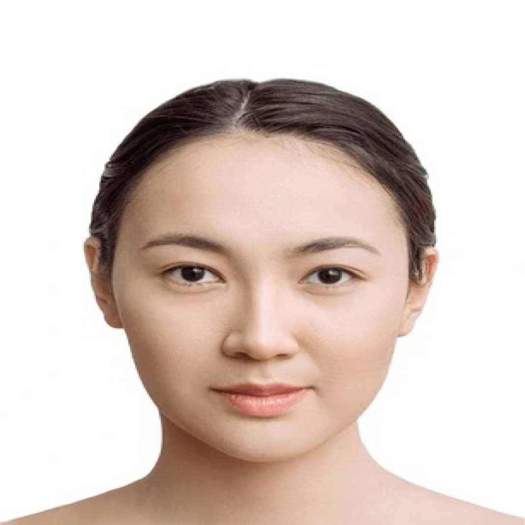 Mesobrightening Skin Treatment Before and After 111
