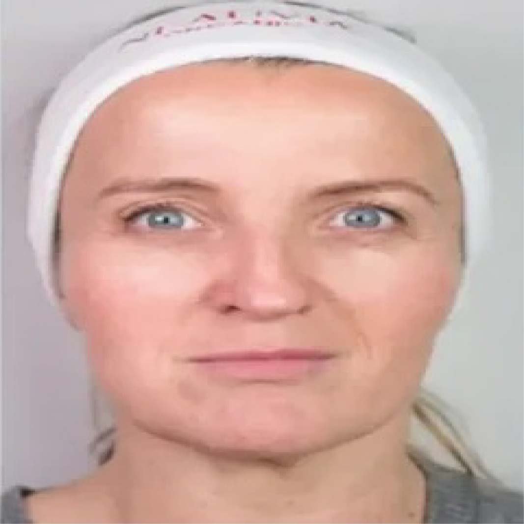 Hydro Deluxe Skin Booster 