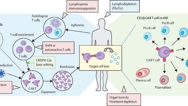 Stem cell therapy for autoimmune diseases at Nexus Clinic in Malaysia.