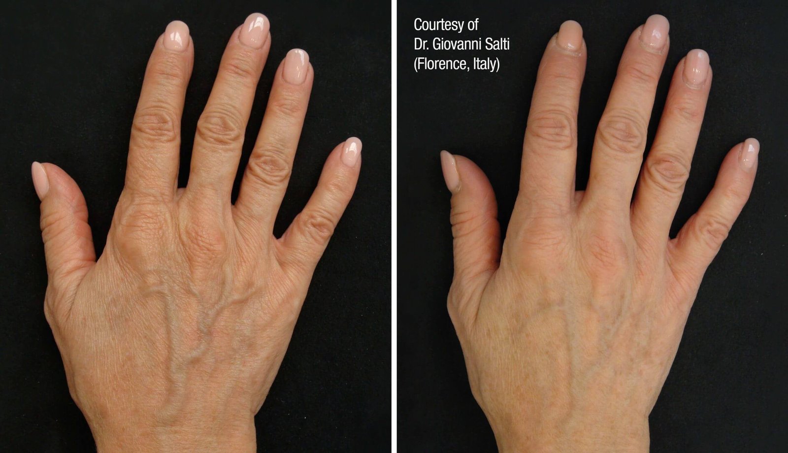 Hands-scaled Hands scaled 1