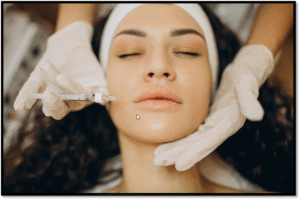 Botox treatment
