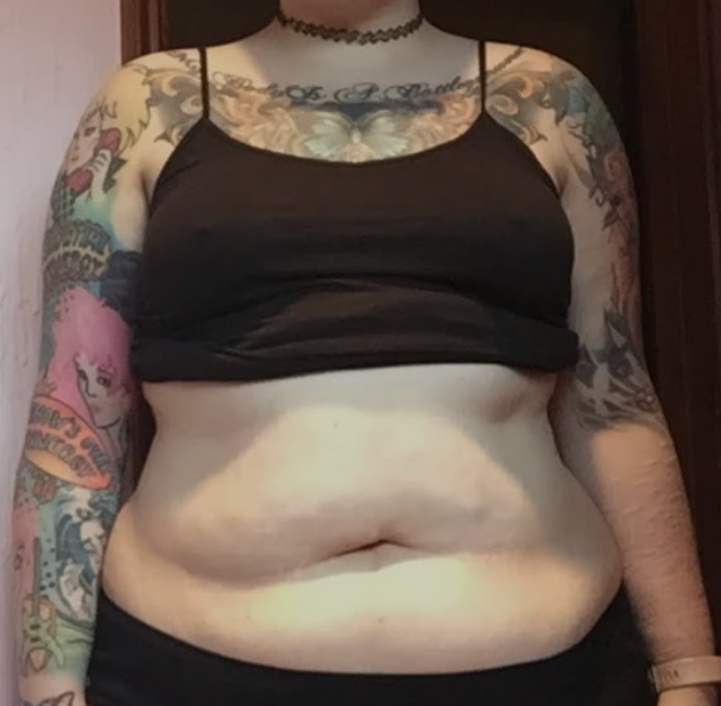 tirzepatide treatment malaysia