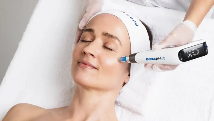 RF Microneedling PRP