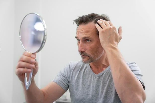 hair loss treatment Kuala Lumpur