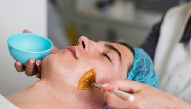 Chemical Peels Safety