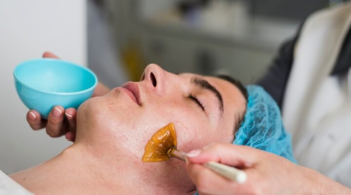 Chemical Peels Safety