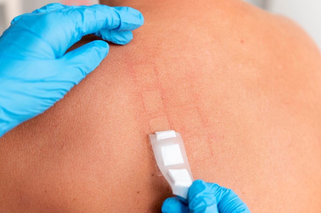 scar treatment clinic